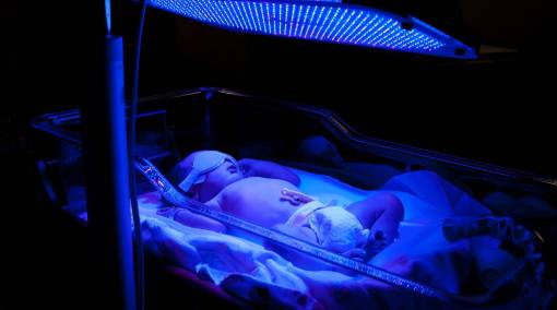Babies-–-Newborn-jaundice-What-you-need-to-know-1